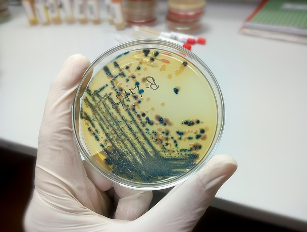 Worker inspecting mold